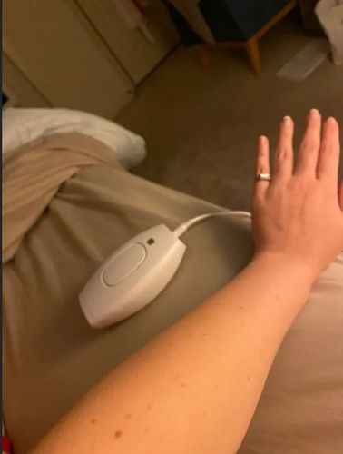 Customer photo review of WONDER SKIN HAIR REMOVAL ORGINAL CLASSIC PRO
