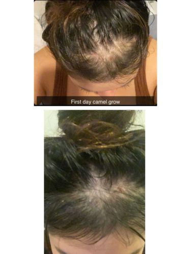 Customer photo review of Growth & Shine Hair Oil