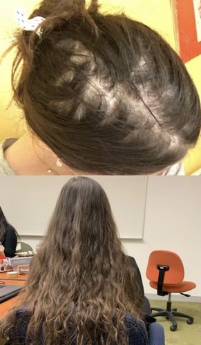 Customer photo review of Growth & Shine Hair Oil