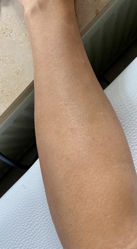 Customer photo review of WONDER SKIN HAIR REMOVAL ORGINAL CLASSIC PRO
