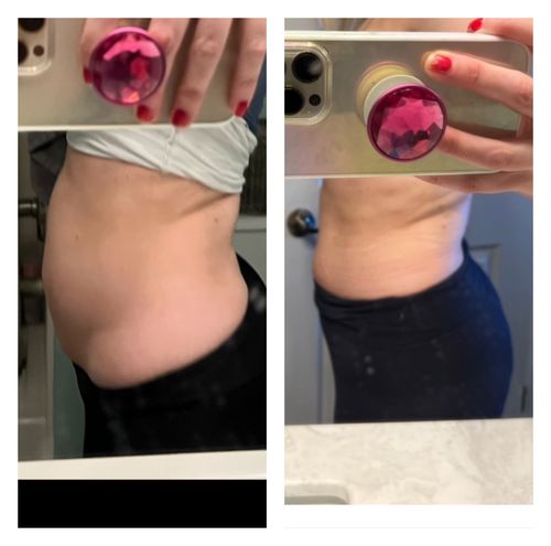 Customer photo review of FREE with one time code -FREESAMPLE- at Checkout: Cotton Wrap and Refill Magnesium Therapy Brew Bag