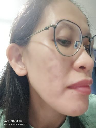 Customer photo review of CLEF RADIANT GOLD ESSENCE (30ml)