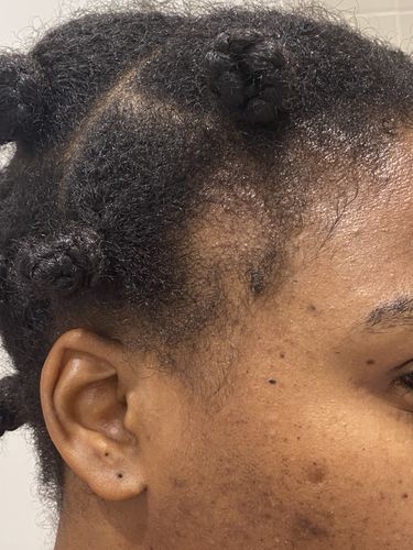 Customer photo review of Drizzle - Hydrating Mist