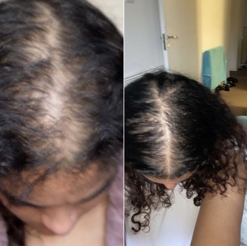 Customer photo review of Inches - Hair & Beard Oil