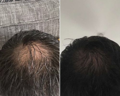 Customer photo review of Inches - Hair & Beard Oil
