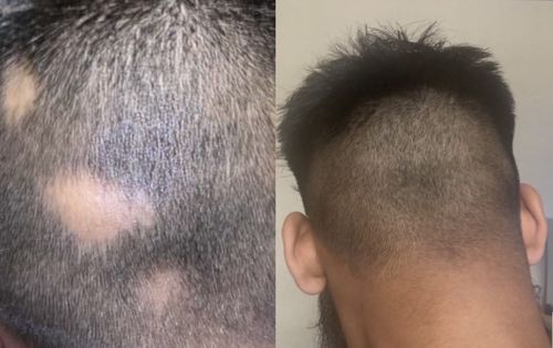 Customer photo review of Inches - Hair & Beard Oil