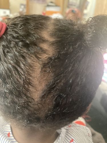Customer photo review of Kid's Super healthy Hair kit