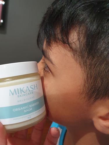 Customer photo review of Organic Barrier Balm