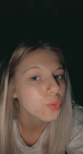 Customer photo review of Micro Gem Hinged Nose Hoop