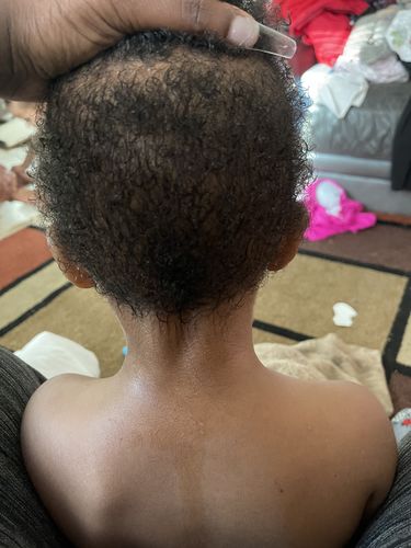 Customer photo review of Kid's Super healthy Hair kit