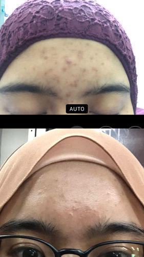 Customer photo review of Face Set (Brightening Face Creme & Night Repair Creme)