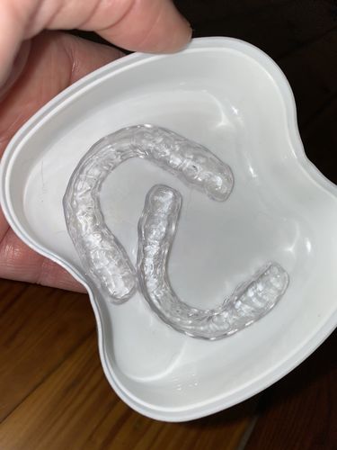 Customer photo review of Extra Impression Putty (STRONGLY RECOMMENDED)