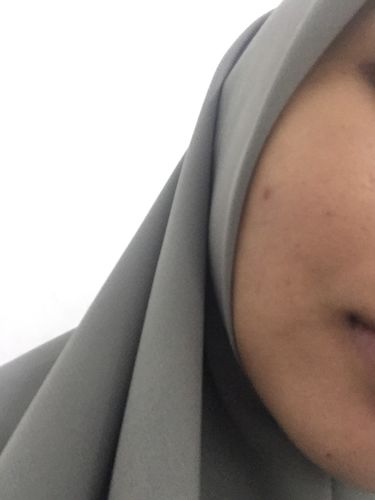 Customer photo review of Triple Action Serum