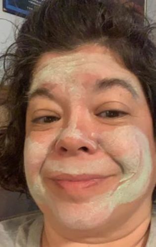Customer photo review of Hot Sale - Deep Cleanse Natural Green Tea Face Mask