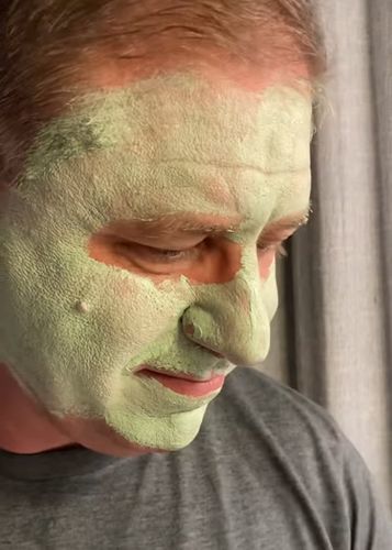 Customer photo review of Hot Sale - Deep Cleanse Natural Green Tea Face Mask