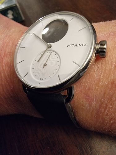 Kundenbewertung mit Foto zu Withings ScanWatch