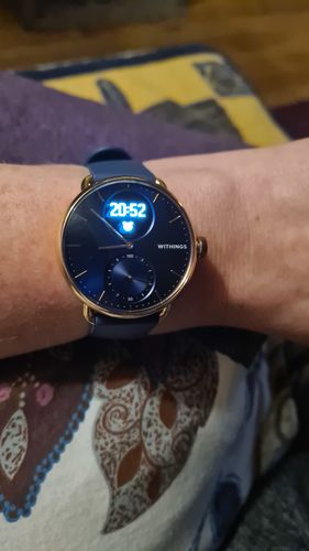 Kundenbewertung mit Foto zu Withings ScanWatch