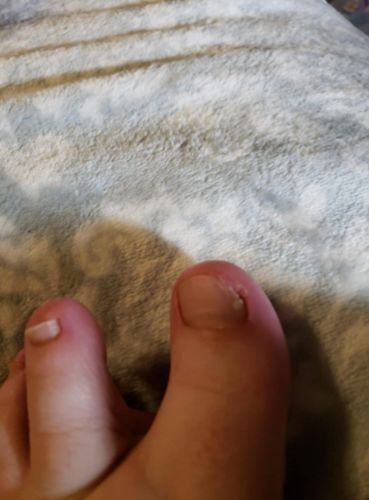 Customer photo review of Health Toe Instant Beauty Gel