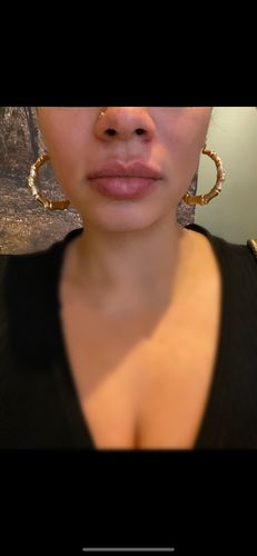 Customer photo review of LipFix: Filler