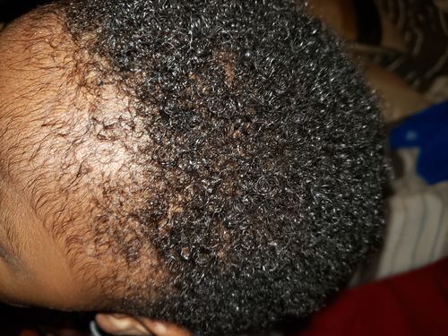 Customer photo review of Kid's Super healthy Hair kit