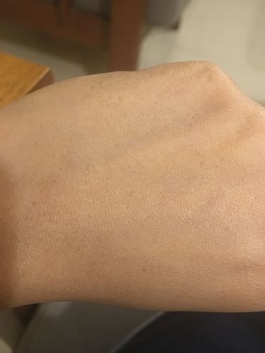 Customer photo review of DEEP NOURISH Rosehip Calendula and Shea Butter Balm for skin, hair & nails