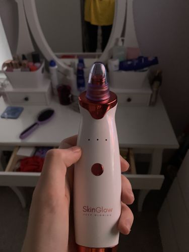 Customer photo review of SkinGlow Electric Cleanser - No More Blackheads