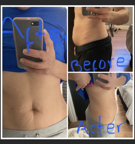 Customer photo review of (BOGO) Topical Magnesium Herbal Brew Refill Brew Bag