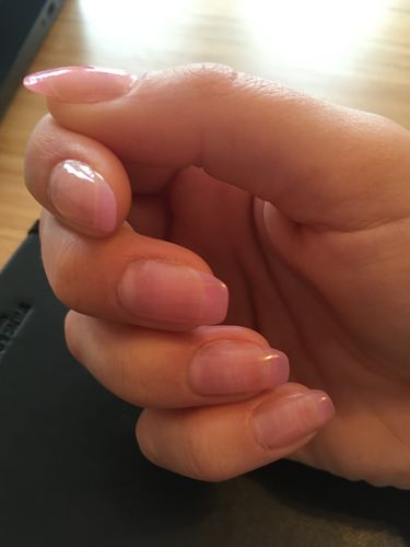 Customer photo review of French Collection Poly Nail Gel Extension Kit