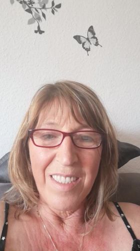 Customer photo review of Hochkonzentriertes Hyaluronsäure Tag & Nacht Gel, Quicklift Pro | 50 ml