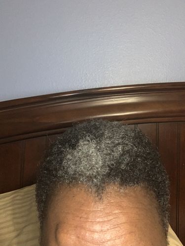 Customer photo review of Nae Nae's 9oz Hair Boost Special