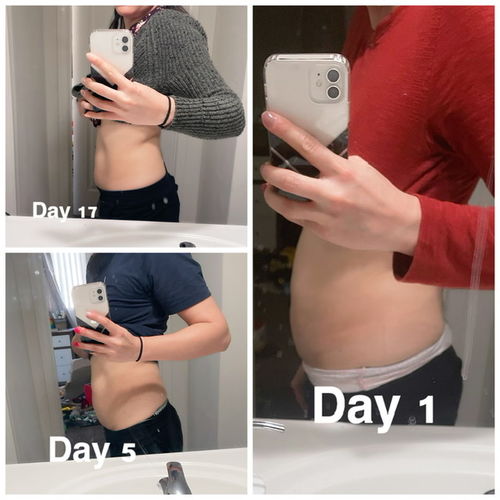 Customer photo review of 15 Uses Magnesium Therapy Herbal Wrap