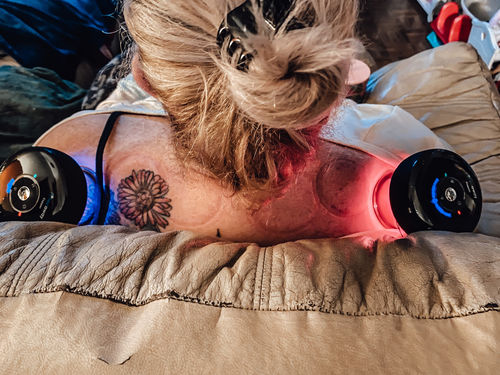 Customer photo review of Achedaway Cupper - The Smart Cupping Therapy Massager
