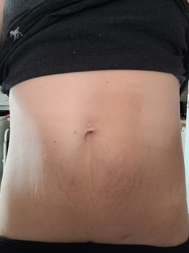 Customer photo review of GIFT 15 Uses Magnesium Therapy Herbal Wrap for Bloat, constipation, loose skin, low energy.