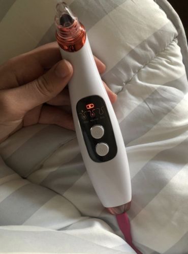 Customer photo review of Solvani Visible Pore Vacuum