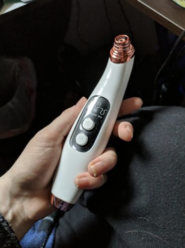 Customer photo review of Solvani Visible Pore Vacuum