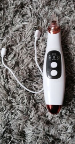 Customer photo review of Solvani Visible Pore Vacuum