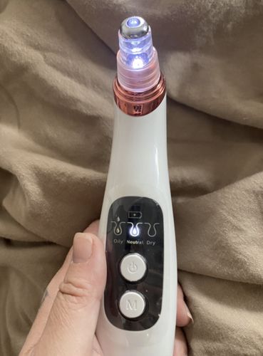 Customer photo review of Solvani Visible Pore Vacuum