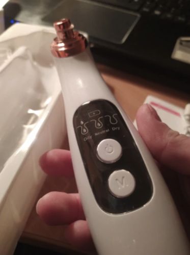 Customer photo review of Solvani Visible Pore Vacuum