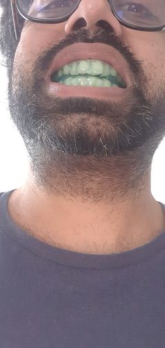 Customer photo review of SleepPro Custom 14 Day Post Delivery Day Offer