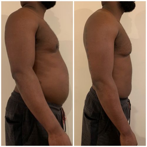 Customer photo review of 21 Day Nulife Detox 3 Product Bundle