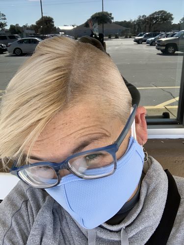 Customer photo review of Triple Acid Enzyme Peel