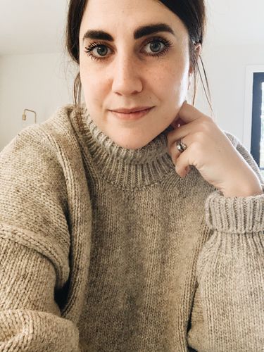Customer photo review of Freckle Stain