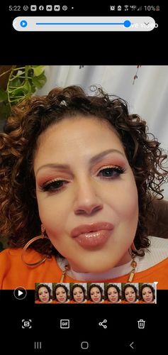 Customer photo review of SkinFix: Laser Genesis
