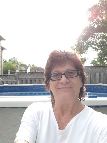 Customer photo review of Premium Arthritis Compression Gloves For Men & Women