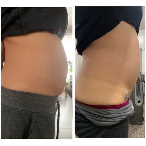 Customer photo review of 45 Uses Herbal Magnesium Therapy Wrap: Legs/Core