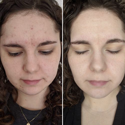 Customer photo review of Rejuvenating Foaming Cleanser
