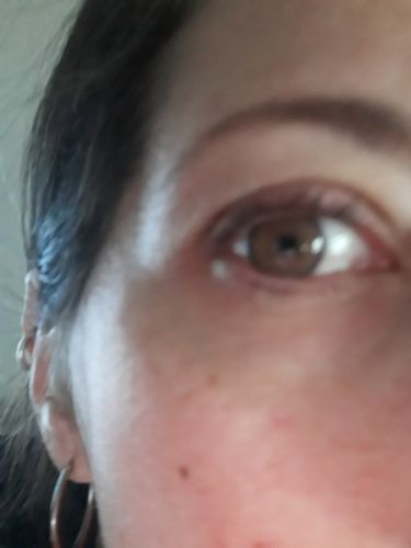 Customer photo review of Neala Brown Contact Lenses(12 months wear)