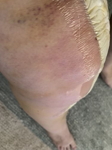 Customer photo review of PREORDER - Myoball Twin Pack - 80mm & 60mm