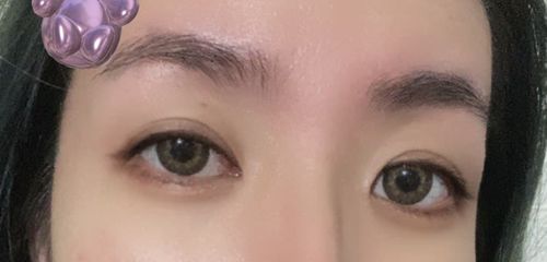 Customer photo review of Catchy Choco (1pcs) (Buy 1 Get 1 Free) 3Monthly G.DIA 13.4mm