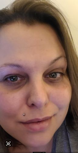 Customer photo review of Supercharged Skincare Bundle